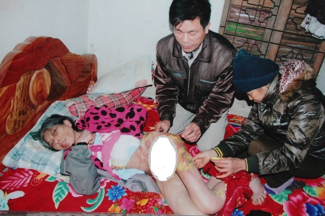 Gia đình đau xót thấy bà Phương trong hoàn cảnh thương tâm này Gia đình đau xót thấy bà Phương trong hoàn cảnh thương tâm này