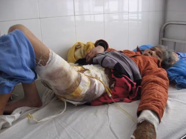 Mong muốn có tiền phụng dưỡng mẹ già mà bà Phương bị hành hạ đến nông nỗi này