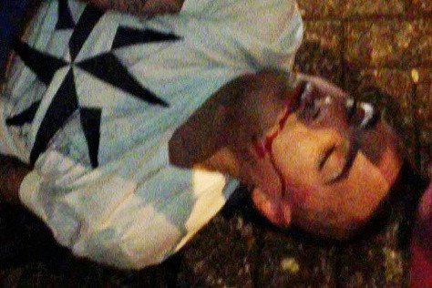 Danny Simpson nằm bất tỉnh trên phố, máu chảy đầy mặt sau vụ ẩu đả (ảnh: The Sun)