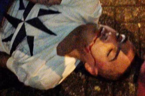 Danny Simpson nằm bất tỉnh trên phố, máu chảy đầy mặt sau vụ ẩu đả (ảnh: The Sun)