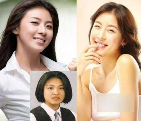 Có thể thấy bây giờ trông những đường nét trên mặt Ha Ji Won đã tinh tế hơn rất nhiều, đặc biết sống mũi cũng cao hơn, đây chính là điểm nghi vấn của giới truyền thông về chiếc mũi thẳng bất ngờ của cô. Có thể thấy bây giờ trông những đường nét trên mặt Ha Ji Won đã tinh tế hơn rất nhiều, đặc biết sống mũi cũng cao hơn, đây chính là điểm nghi vấn của giới truyền thông về chiếc mũi thẳng bất ngờ của cô.