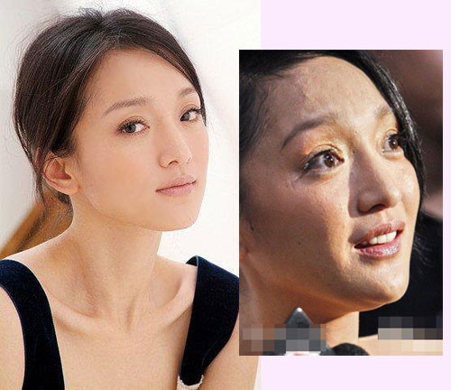 Có thể không tưởng tượng được rằng làn da của người đẹp sở hữu chiếc cằm nhọn cuốn hút lại có thể xấu đến mức độ này, vừa rỗ vừa đen mà không được mịn màng như chúng ta thường thấy. Có vẻ Châu Tấn đã chăm sóc da không đúng cách. Có thể không tưởng tượng được rằng làn da của người đẹp sở hữu chiếc cằm nhọn cuốn hút lại có thể xấu đến mức độ này, vừa rỗ vừa đen mà không được mịn màng như chúng ta thường thấy. Có vẻ Châu Tấn đã chăm sóc da không đúng cách.