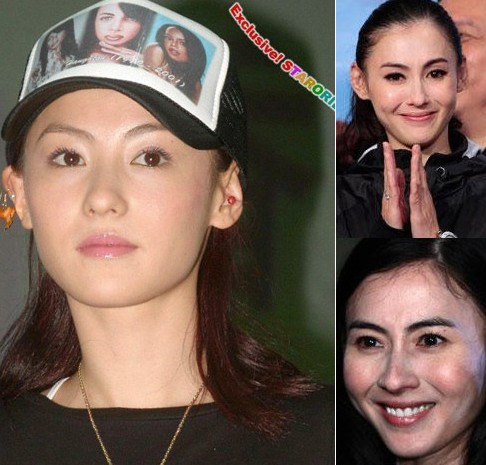 Da của Trương Bá Chi thuộc loại da nhờn rất dễ dẫn đến mụn trứng cá, còn có dấu hiệu của vết nám dù chăm sóc thế nào cũng không có tác dụng, lúc nhìn gần sẽ thấy làn da rất bóng đó chính là biểu hiện của da nhờn. Da của Trương Bá Chi thuộc loại da nhờn rất dễ dẫn đến mụn trứng cá, còn có dấu hiệu của vết nám dù chăm sóc thế nào cũng không có tác dụng, lúc nhìn gần sẽ thấy làn da rất bóng đó chính là biểu hiện của da nhờn.