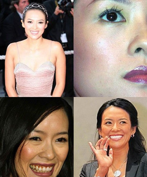 Ngôi sao quốc tế Chương Tử Di sở hữu một làn da khá tốt nhưng điểm yếu lại chính là những nốt thâm mụn và tàn nhang trên làn da mịn màng đó. Ngôi sao quốc tế Chương Tử Di sở hữu một làn da khá tốt nhưng điểm yếu lại chính là những nốt thâm mụn và tàn nhang trên làn da mịn màng đó.