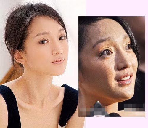 Có thể không tưởng tượng được rằng làn da của người đẹp sở hữu chiếc cằm nhọn cuốn hút lại có thể xấu đến mức độ này, vừa rỗ vừa đen mà không được mịn màng như chúng ta thường thấy. Có vẻ Châu Tấn đã chăm sóc da không đúng cách.