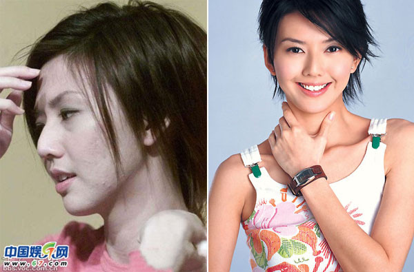 Tôn yến Tư khiến mọi người phát hoảng với ảnh cận mặt vừa mụn vừa rộ của “người đẹp”, thật không thể tin được đây là làn da thật của cô ca sĩ đình đám xứ Trung này. Xêm thêm: Ngao ngán khi Sao rủ nhau tụt cân không phanh/ Điểm danh những chiếc cằm mới của Sao Việt.