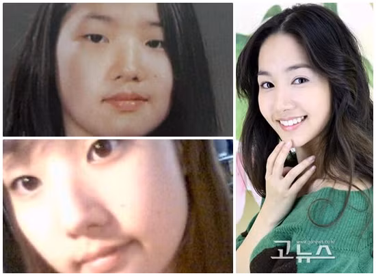 Park Min Young trước đến nay luôn thẳng thắn mình là ‘mỹ nhân thẩm mỹ”, dù là thế nhưng nếu đối chiếu với lúc trước khi với mắt một mí, mũi thấp, mặt ú thì thực sự cảm giác khác nhau rất xa. Xem thêm: Trang điểm giúp Vịt hóa "Thiên Nga / Bộ sưu tập váy xinh chào hè 2012.