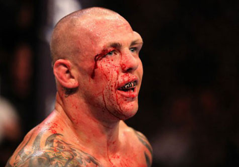 Sự phẫn nộ của người Anh sẽ tạm nguôi nếu được chứng kiến Ross Pearson trừng trị John Terry Sự phẫn nộ của người Anh sẽ tạm nguôi nếu được chứng kiến Ross Pearson trừng trị John Terry