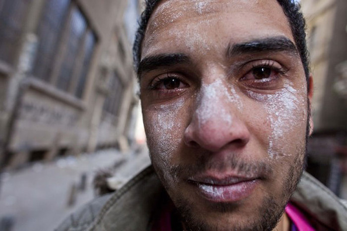 Đây là một người bị nhiễm hơi cay sau khi đụng độ cảnh sát Đây là một người bị nhiễm hơi cay sau khi đụng độ cảnh sát