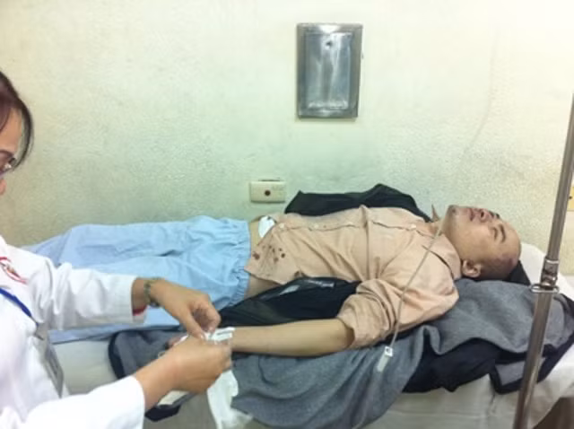 Anh Nguyễn Tài Quyền đang được điều trị tại BV Việt Đức (ảnh Dantri.vn)