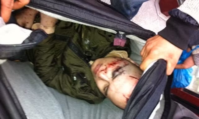 Nạn nhân Nguyễn Tài Quyền may mắn sống sót tại Yên Tử (ảnh Dantri.vn)