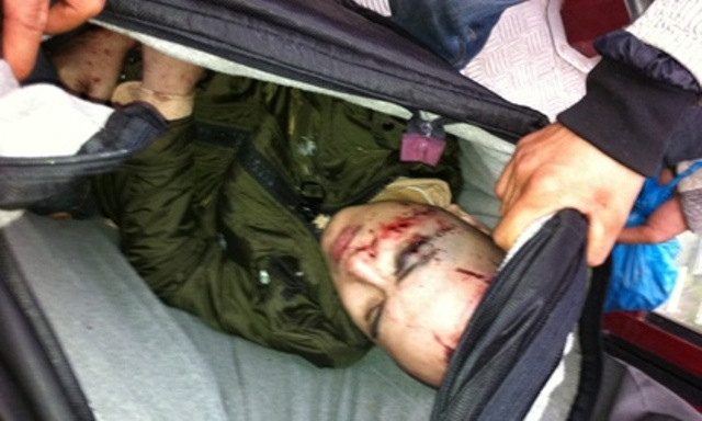 Nạn nhân Nguyễn Tài Quyền may mắn sống sót tại Yên Tử (ảnh Dantri.vn) Nạn nhân Nguyễn Tài Quyền may mắn sống sót tại Yên Tử (ảnh Dantri.vn)