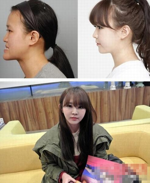 Gương mặt hoàn toàn thay đổi sau những cuộc phẫu thuật. Gương mặt hoàn toàn thay đổi sau những cuộc phẫu thuật.