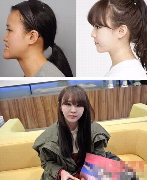 Gương mặt hoàn toàn thay đổi sau những cuộc phẫu thuật.