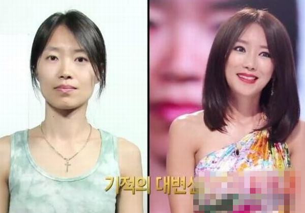 Nếu quá xấu qua phẫu thuật sẽ trở nên xinh hơn. Nếu quá xấu qua phẫu thuật sẽ trở nên xinh hơn.