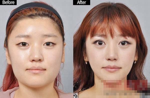 Sự hiện đại của khoa học đã giúp các cô gái tự tin hơn khi thay đổi ngoại hình của mình. Sự hiện đại của khoa học đã giúp các cô gái tự tin hơn khi thay đổi ngoại hình của mình.