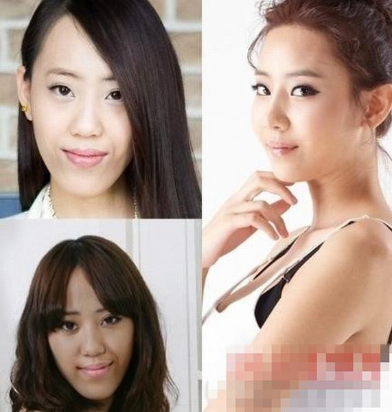 Nụ cười có ý nghĩa rất lớn trên khuôn mặt, do đó chỉnh sửa hàm răng có tầm quan trọng rất lớn. Nụ cười có ý nghĩa rất lớn trên khuôn mặt, do đó chỉnh sửa hàm răng có tầm quan trọng rất lớn.