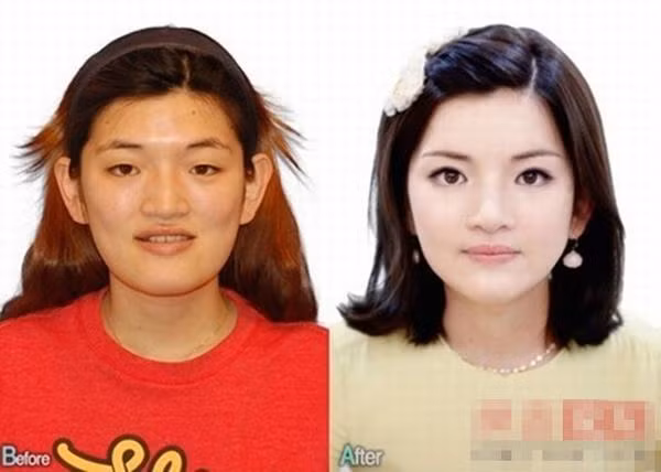 Nâng mũi, cắt mí, gọt cằm là yêu cầu bình thường khi tới thẩm mỹ viện.