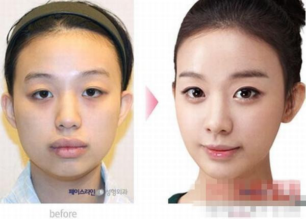 Trở thành hot girl sau phẫu thuật. Trở thành hot girl sau phẫu thuật.