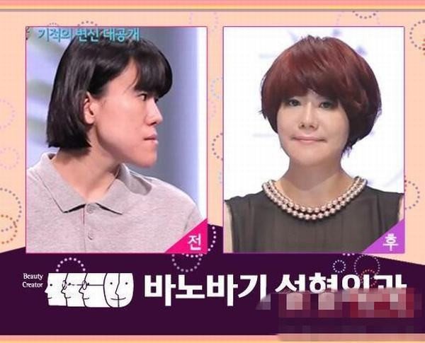 Gọt cằm đang là loại hình được ưu chuộng hiện nay, bởi ai cũng muốn sở hữu một gương mặt thon nhỏ và cuốn hút. Gọt cằm đang là loại hình được ưu chuộng hiện nay, bởi ai cũng muốn sở hữu một gương mặt thon nhỏ và cuốn hút.