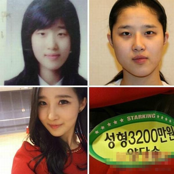 Phẫu thuật hai mí, chỉnh cằm, chỉnh mũi chuẩn không cần chỉnh. Phẫu thuật hai mí, chỉnh cằm, chỉnh mũi chuẩn không cần chỉnh.