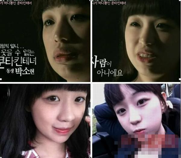 Trị răng hô dường như mà một tiểu phẫu nhỏ so với công nghệ thẩm mỹ xứ Hàn. Trị răng hô dường như mà một tiểu phẫu nhỏ so với công nghệ thẩm mỹ xứ Hàn.