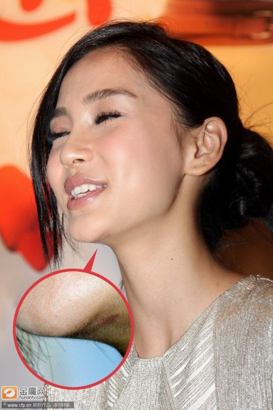 Phóng viên đã bất ngờ phát hiện ra 1 vết sẹo lạ dưới cằm của Angela Baby Phóng viên đã bất ngờ phát hiện ra 1 vết sẹo lạ dưới cằm của Angela Baby