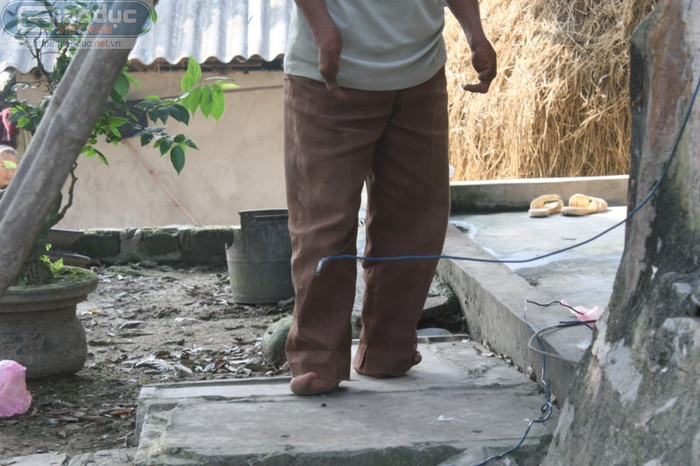 Người ta gọi đại gia đình ấy là "gia đình chân chim" vì hai đời nhà họ tứ chi chỉ có 1 ngón. Người ta gọi đại gia đình ấy là "gia đình chân chim" vì hai đời nhà họ tứ chi chỉ có 1 ngón.