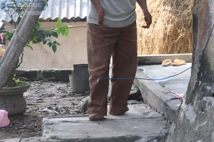 Người ta gọi đại gia đình ấy là "gia đình chân chim" vì hai đời nhà họ tứ chi chỉ có 1 ngón. Người ta gọi đại gia đình ấy là "gia đình chân chim" vì hai đời nhà họ tứ chi chỉ có 1 ngón.