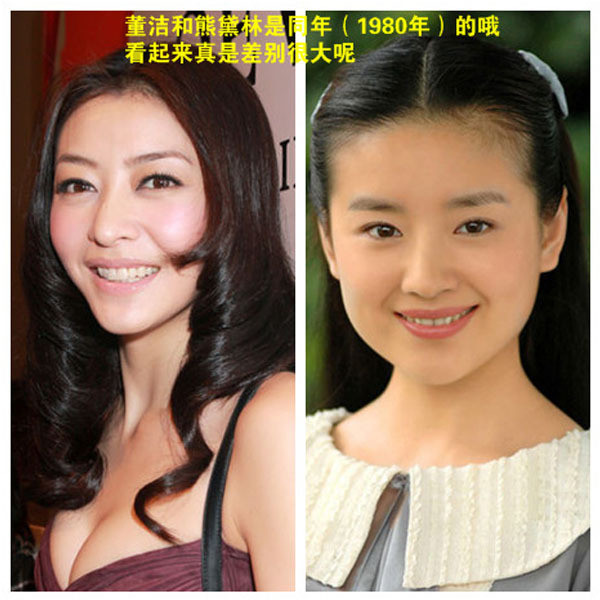 Hùng Đại Lâm và Đổng Khiết đều sinh cùng năm 1980, nhưng một bên nàng ngọc nữ Đổng Khiết vẫn rất trẻ và thuần khiết, còn Hùng Đại Lâm lại nhìn rất già dặn. Hùng Đại Lâm và Đổng Khiết đều sinh cùng năm 1980, nhưng một bên nàng ngọc nữ Đổng Khiết vẫn rất trẻ và thuần khiết, còn Hùng Đại Lâm lại nhìn rất già dặn.