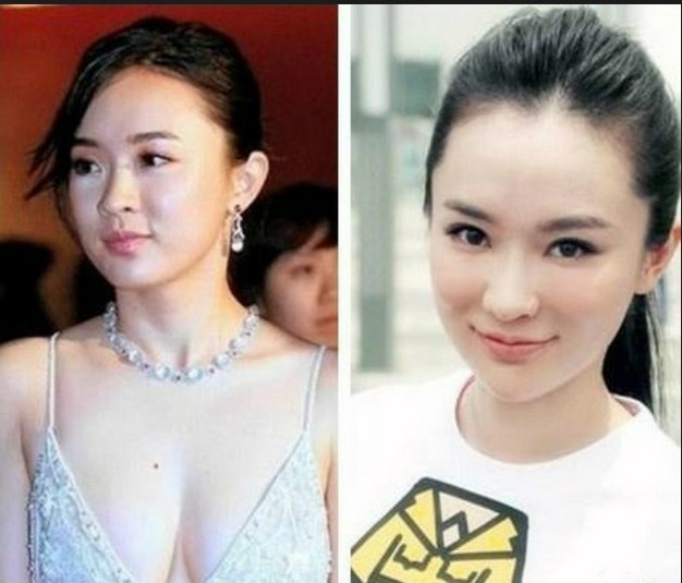 Hai má ú tròn của Hoắc Tư Yến đã nhỏ hơn khiến khuôn mặt của cô thon hơn.