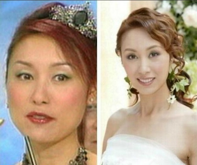 Quách Khả Doanh mặt thon hơn là do gầy đi hay là do tác động của dao kéo?