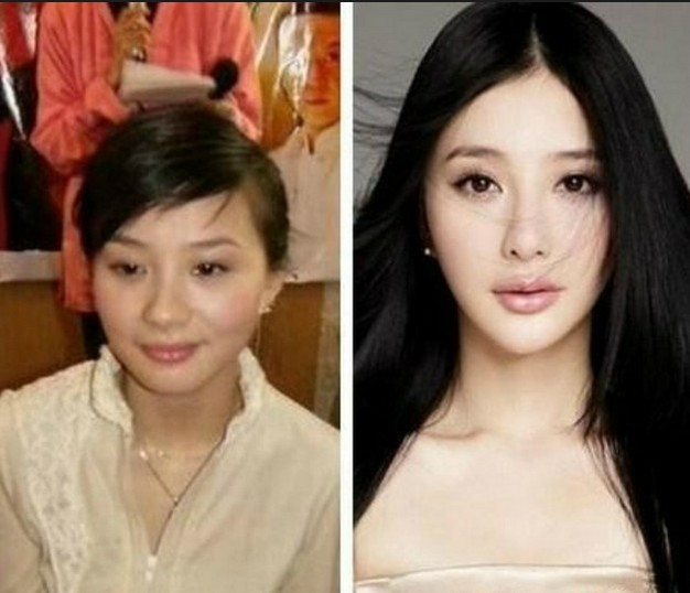 Khuôn mặt của Hùng Nãi Cẩn liệu có phải là khuôn mặt tự nhiên không?