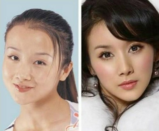 Tôn Phi Phi, tựa như hai khuôn mặt của hai người khác nhau, thay đổi rất lớn.