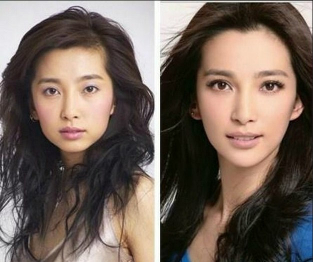 Bằng chứng gọt cằm của Lý Băng Băng khá rõ.