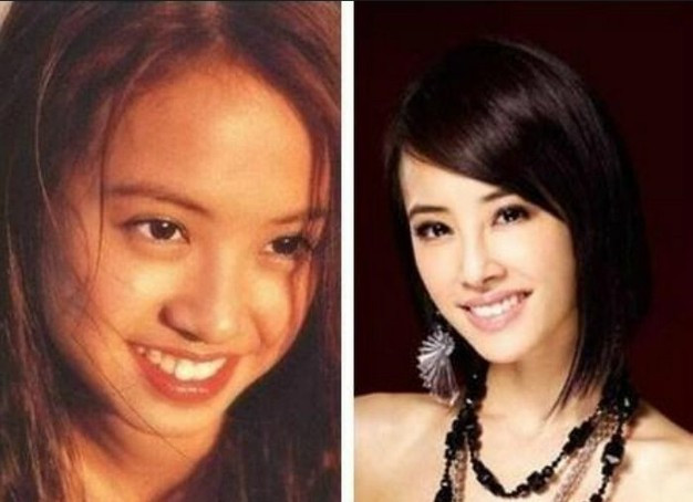 Thái Y Lâm với hai khuôn mặt khác nhau hoàn toàn, liệu cũng là hiệu quả của gọt cằm chăng?