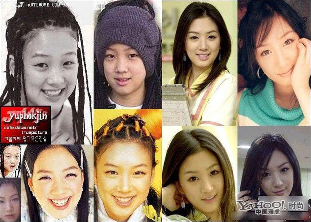 Jung Ryeo Won mũi cao, mắt to, cằm nhọn đều chỉ là sản phẩm của phẫu thuật thẩm mỹ. Ảnh: Yahoo