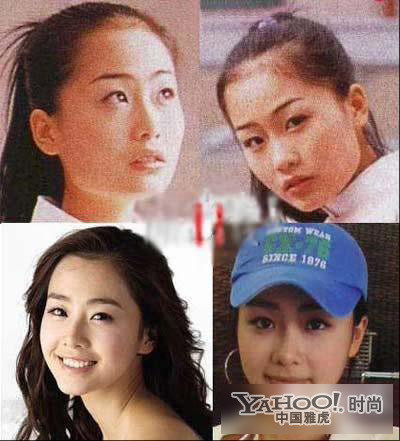 Hong Soo Hyun cũng trông tránh được việc nhờ dao kéo để trẻ thành "mỹ nhân". Ảnh: Yahoo
