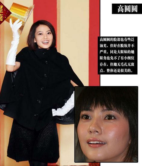 Dù đã trang điểm khá đậm nhưng hai bên má của Cao Viên Viên vẫn khá rỗ.