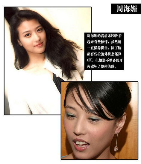 Càng già thì hàm răng hô của Châu Hải Mi càng thể hiện rõ.