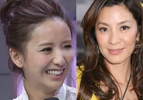 Khuyết điểm lớn nhất trên gương mặt Đồng Lệ Á là có quá nhiều nếp nhăn ở vùng mắt khiến cô trông già hơn tuổi rất nhiều, thậm chí "sánh bằng" cả Dương Tử Quỳnh. Khuyết điểm lớn nhất trên gương mặt Đồng Lệ Á là có quá nhiều nếp nhăn ở vùng mắt khiến cô trông già hơn tuổi rất nhiều, thậm chí "sánh bằng" cả Dương Tử Quỳnh.