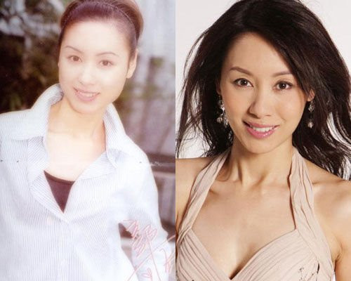 Hai gò má ú bánh đúc của Quách Khả Doanh phải chăng đã nhờ dao kéo để trở nên thon gọn hẳn đi. Hai gò má ú bánh đúc của Quách Khả Doanh phải chăng đã nhờ dao kéo để trở nên thon gọn hẳn đi.