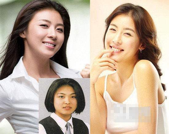 Ha Ji Won liệu có phải là nhờ thẩm mỹ để trở thành mỹ nhân không? Ha Ji Won liệu có phải là nhờ thẩm mỹ để trở thành mỹ nhân không?