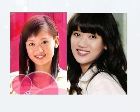 Liệu có phải Trần Kiều Ân đã đi sửa răng, cằm không? Liệu có phải Trần Kiều Ân đã đi sửa răng, cằm không?