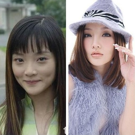 Sự thay đổi của Lý Tiểu Lộ là điều mà ai cũng có thể nhận thấy từ mũi, mắt và khuôn mặt.