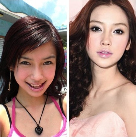 Angela Baby là người đẹp 8x sở hữu một vẻ đẹp làm đắm say lòng người, nhưng để được như hôm nay cô đã phải nhờ đến dao kéo để chỉnh sửa lại hàm răng hô.