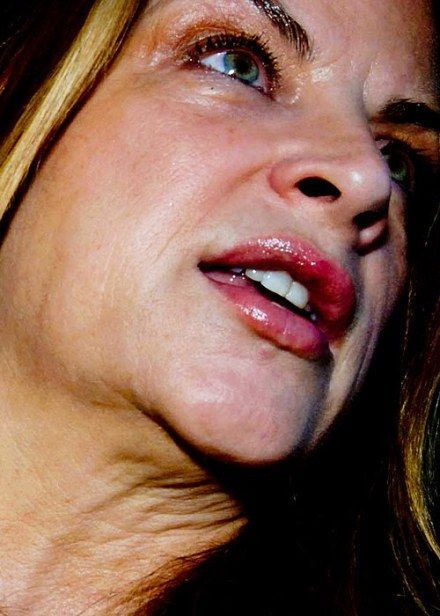 Bức ảnh vô cùng dọa người của Kirstie Alley. Bức ảnh vô cùng dọa người của Kirstie Alley.