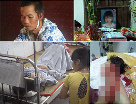 Bức ảnh đang nhận được sự cảm thông sâu sắc từ cộng đồng facebook. Bức ảnh đang nhận được sự cảm thông sâu sắc từ cộng đồng facebook.