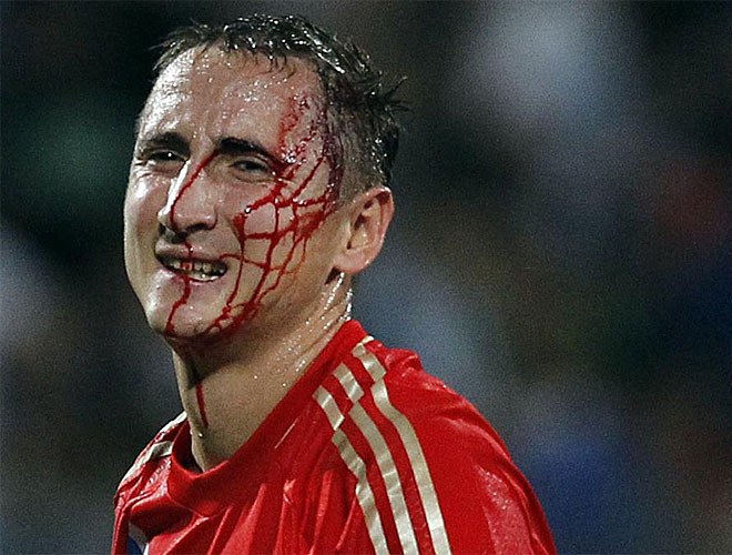 Cái giá của chiến thắng.