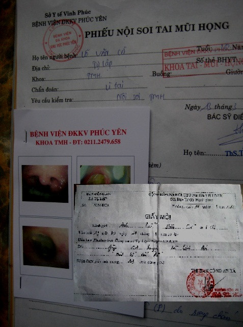 Giấy mời và phiếu nội soi tai mũi họng của Lỗ Văn Cừ Giấy mời và phiếu nội soi tai mũi họng của Lỗ Văn Cừ